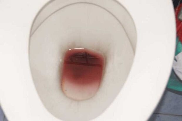 Spotting in men when excited